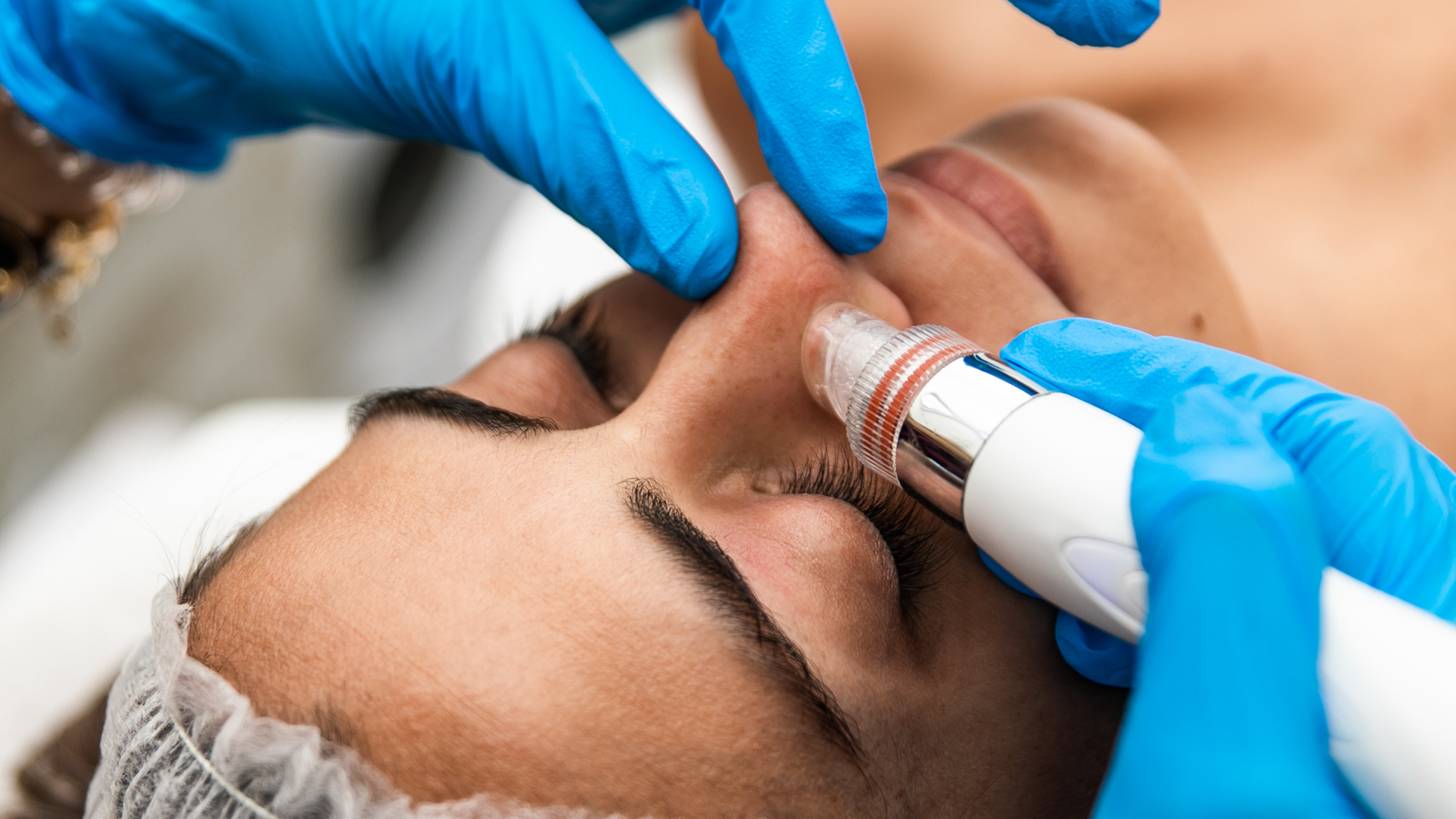 tratamiento facial madrid
