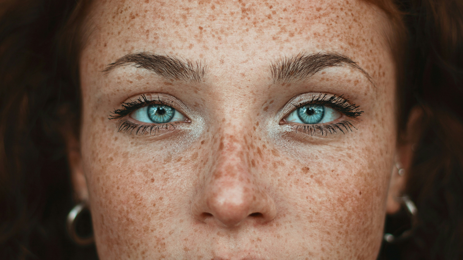 Tratamiento Cosmelan para manchas