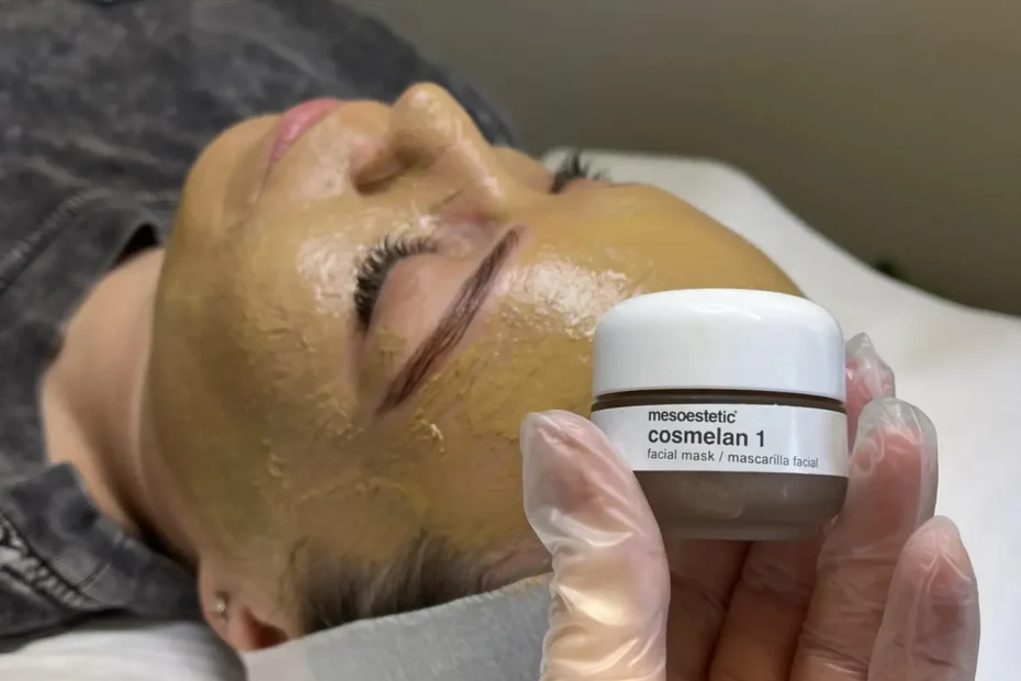 tratamiento Cosmelan en Madrid